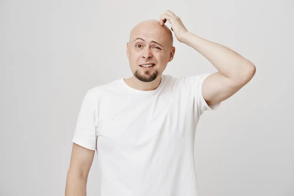 Alopecie