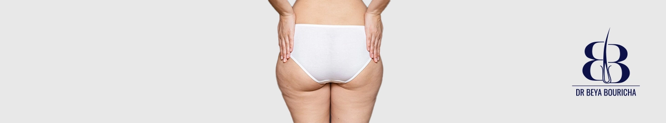 Culotte
