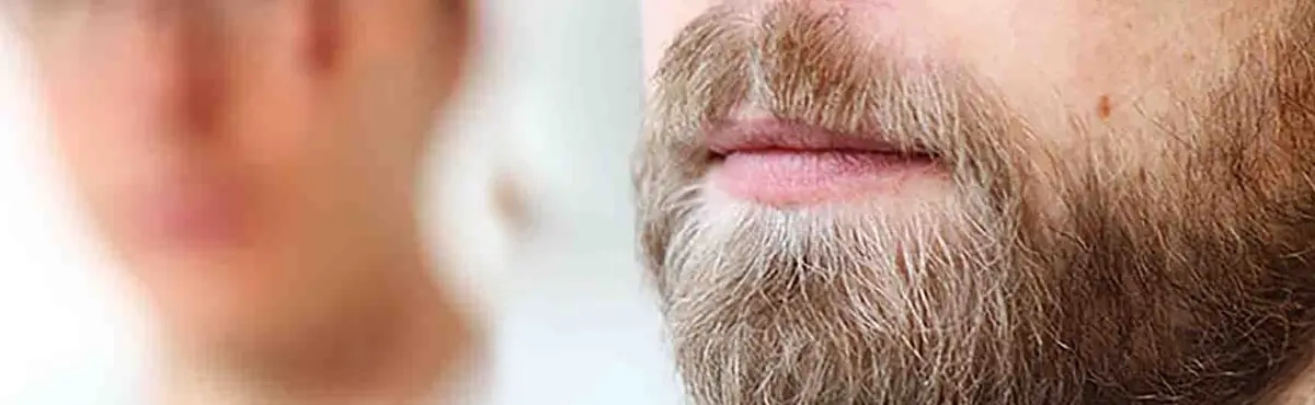 Greffe barbe & moustache Tunisie- Un look masculin affirmé