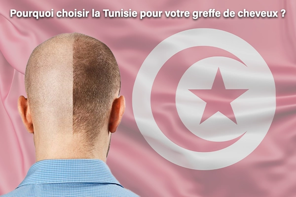 Pourquoi choisir la Tunisie pour votre greffe de cheveux