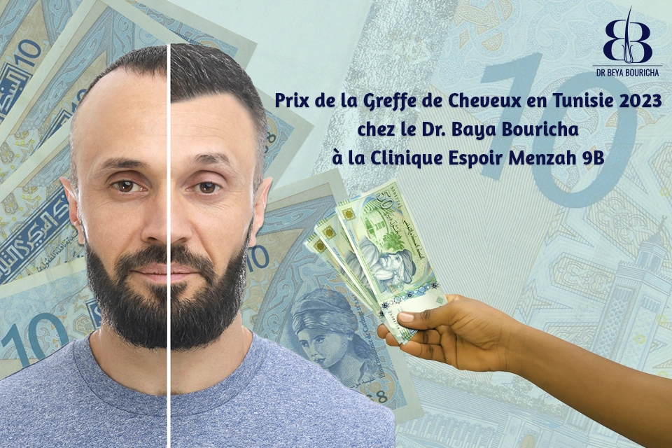 Prix de la Greffe de Cheveux en Tunisie 2023 : Offres Avantageuses et Facteurs Influents des Coûts chez le Dr. Baya Bouricha à la Clinique Espoir Menzah 9B