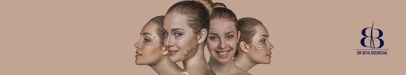 Chirurgie visage