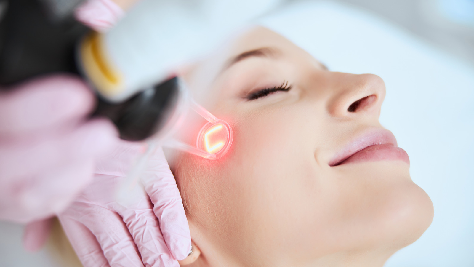 Traitement qualité de peau : que choisir entre mésothérapie, PRP, peeling, laser et radiofréquence ?